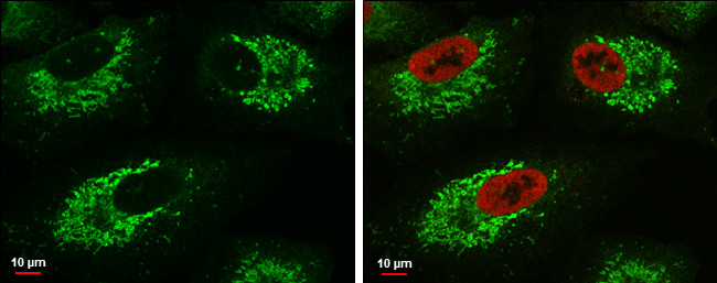 Glutaminase C (GAC) Antibody in Immunocytochemistry (ICC/IF)