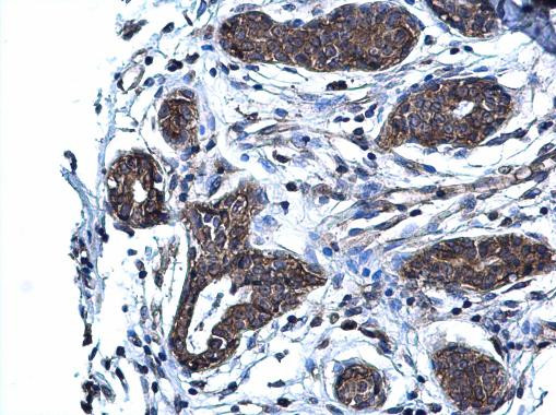 Glutaminase C (GAC) Antibody in Immunohistochemistry (Paraffin) (IHC (P))