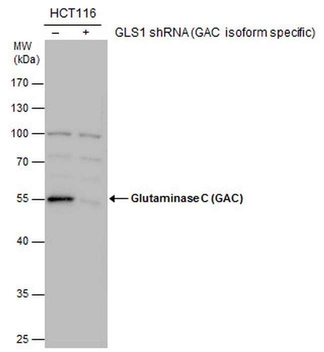 Glutaminase C (GAC) Antibody in Western Blot (WB)