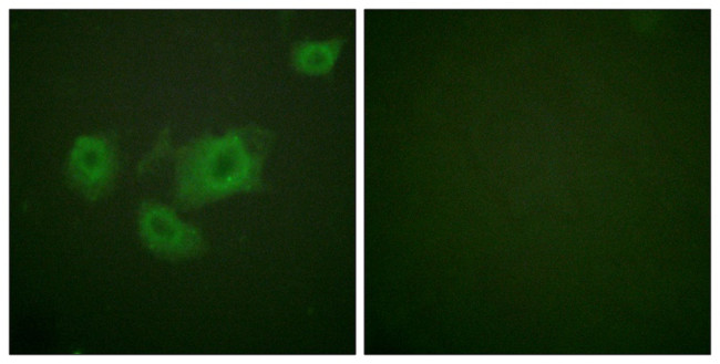 Phospho-Kir6.2 (Thr224) Antibody in Immunocytochemistry (ICC/IF)