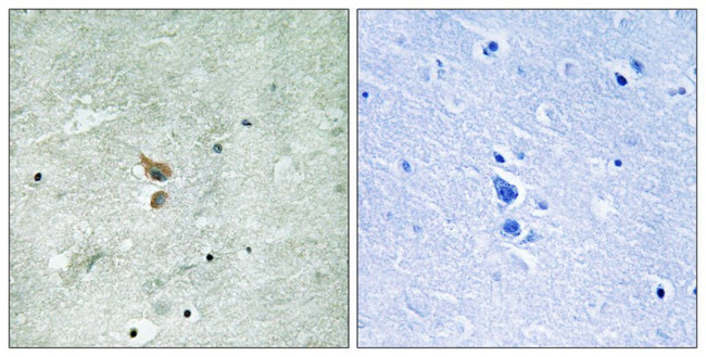 Phospho-RIP2 (Ser176) Antibody in Immunohistochemistry (Paraffin) (IHC (P))