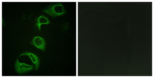 Phospho-ALK (Tyr1604) Antibody in Immunocytochemistry (ICC/IF)