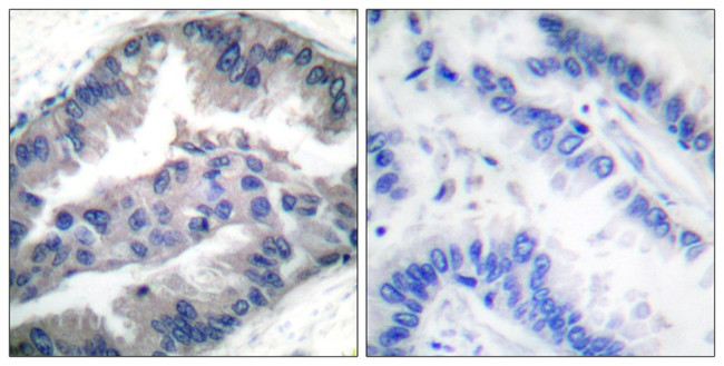 Phospho-BIK (Thr33) Antibody in Immunohistochemistry (Paraffin) (IHC (P))