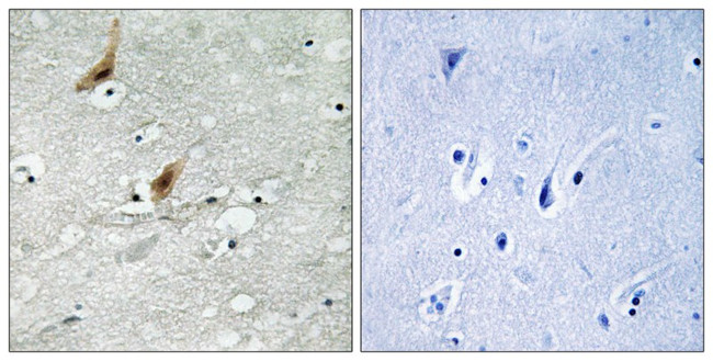 Phospho-MSK2 (Thr568) Antibody in Immunohistochemistry (Paraffin) (IHC (P))