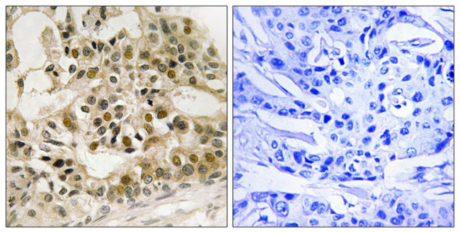 Phospho-Myb (Ser532) Antibody in Immunohistochemistry (Paraffin) (IHC (P))