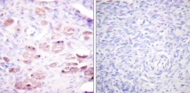 Phospho-DAXX (Ser668) Antibody in Immunohistochemistry (Paraffin) (IHC (P))