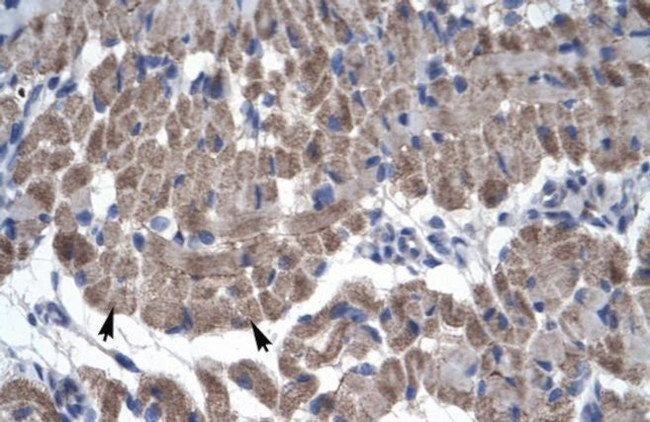 GAS7 Antibody in Immunohistochemistry (Paraffin) (IHC (P))