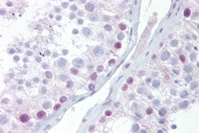 UTF1 Antibody in Immunohistochemistry (IHC)