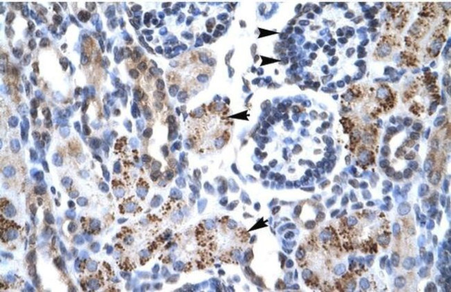 GFI1B Antibody in Immunohistochemistry (Paraffin) (IHC (P))