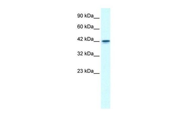 GFI1B Antibody in Western Blot (WB)