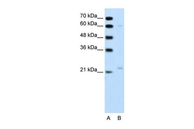 RGS4 Antibody in Western Blot (WB)