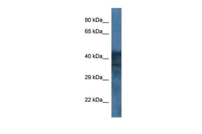 GABRB1 Antibody in Western Blot (WB)