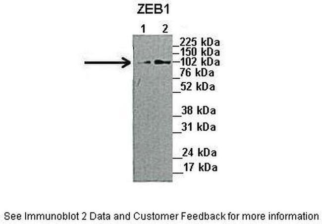 ZEB1 Antibody in Western Blot (WB)