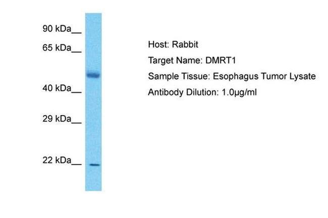 DMRT1 Antibody in Western Blot (WB)