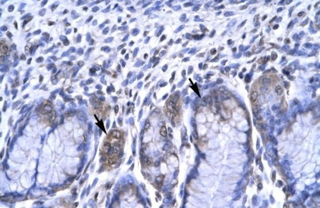 RBPJ Antibody in Immunohistochemistry (IHC)