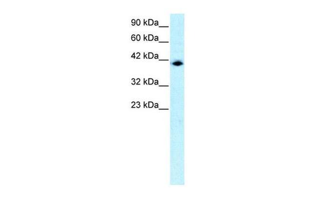 IRF9 Antibody in Western Blot (WB)