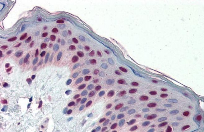 Fra1 Antibody in Immunohistochemistry (Paraffin) (IHC (P))