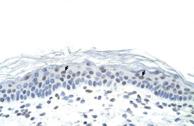 Fra1 Antibody in Immunohistochemistry (Paraffin) (IHC (P))