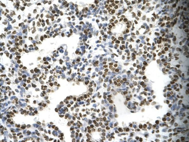 Fra1 Antibody in Immunohistochemistry (Paraffin) (IHC (P))