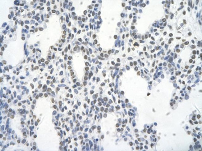 Fra1 Antibody in Immunohistochemistry (Paraffin) (IHC (P))