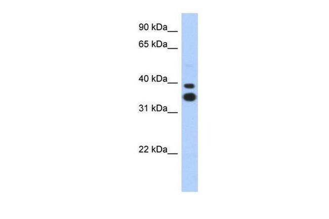 MSX2 Antibody in Western Blot (WB)