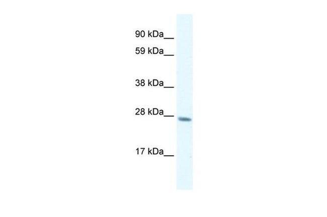 GTF2F2 Antibody in Western Blot (WB)