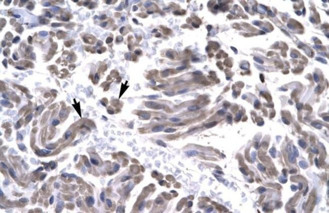 GTF2H3 Antibody in Immunohistochemistry (Paraffin) (IHC (P))