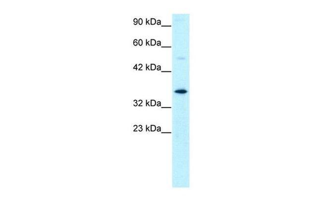 GTF2H3 Antibody in Western Blot (WB)