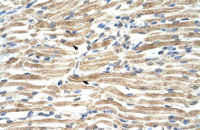 YAF2 Antibody in Immunohistochemistry (IHC)