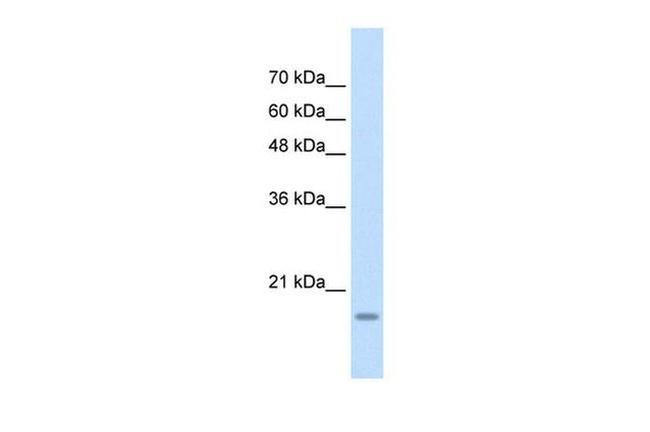 YAF2 Antibody in Western Blot (WB)