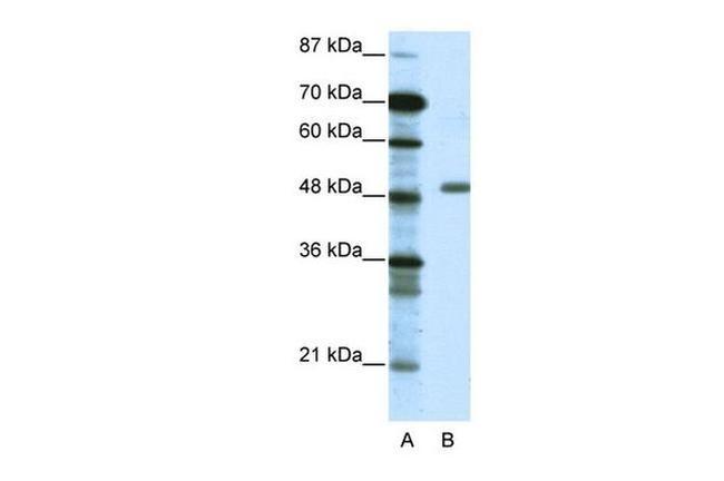 TADA3L Antibody in Western Blot (WB)