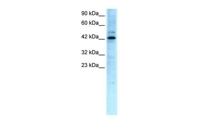 TCFL5 Antibody in Western Blot (WB)