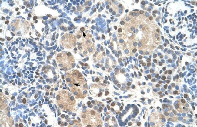 ZNF274 Antibody in Immunohistochemistry (IHC)