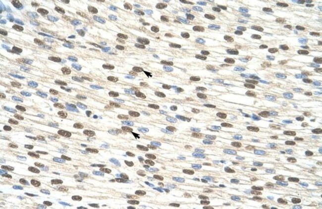 ZNF274 Antibody in Immunohistochemistry (IHC)