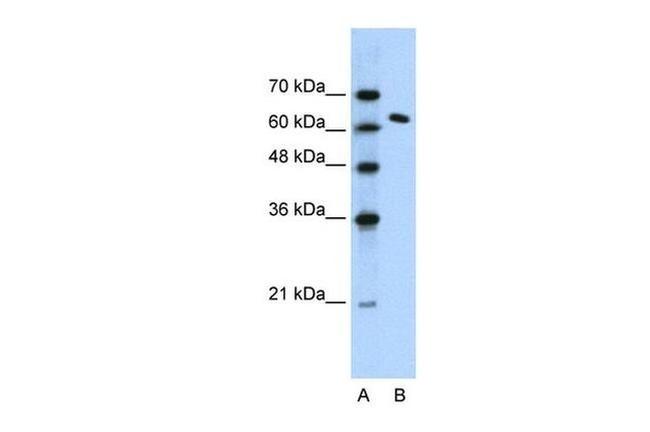 SUPT16H Antibody in Western Blot (WB)