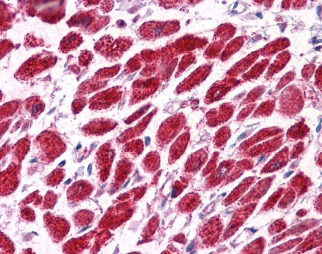 EAP30 Antibody in Immunohistochemistry (Paraffin) (IHC (P))