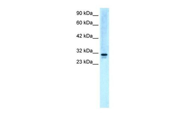 EAP30 Antibody in Western Blot (WB)