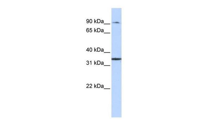 ZFP90 Antibody in Western Blot (WB)