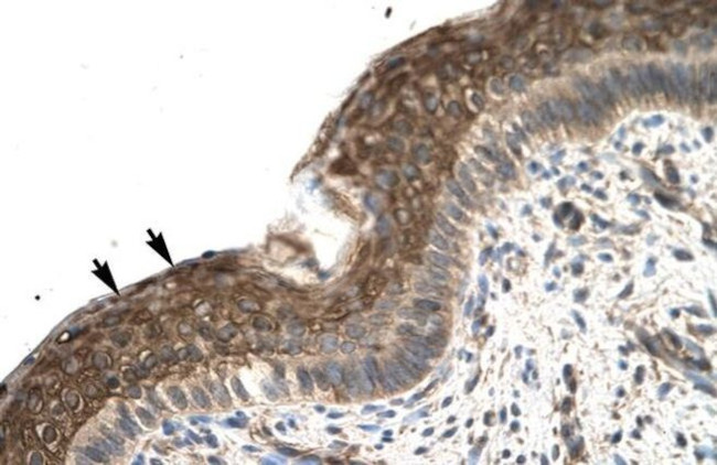 ZFP1 Antibody in Immunohistochemistry (Paraffin) (IHC (P))