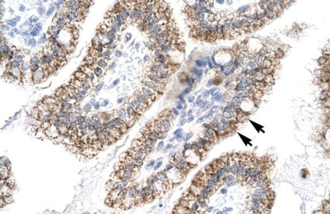 AEBP1 Antibody in Immunohistochemistry (IHC)