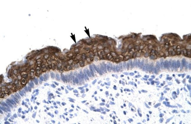 AEBP1 Antibody in Immunohistochemistry (IHC)