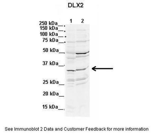 DLX2 Antibody in Western Blot (WB)