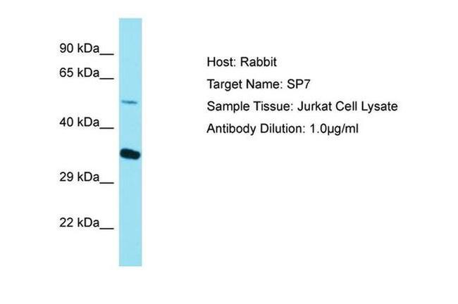 SP7 Antibody in Western Blot (WB)