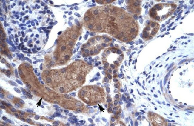 HELIOS Antibody in Immunohistochemistry (IHC)