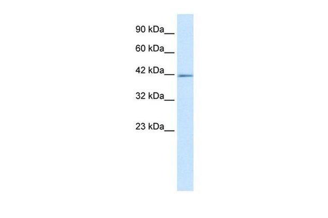 HELIOS Antibody in Western Blot (WB)