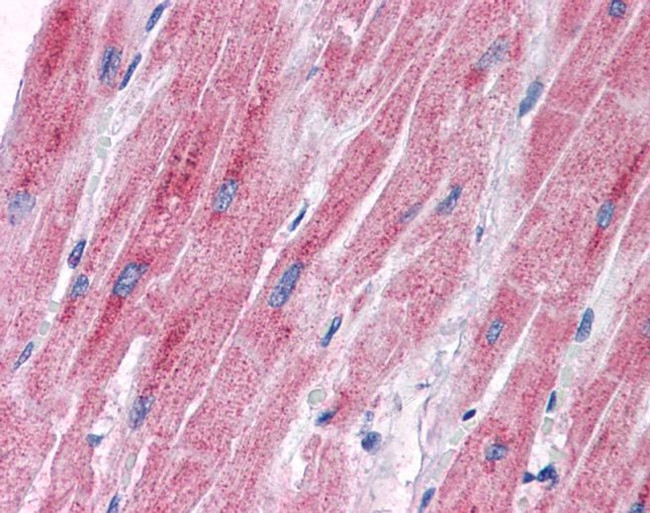 PDK2 Antibody in Immunohistochemistry (IHC)