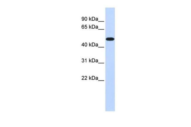 PDK2 Antibody in Western Blot (WB)