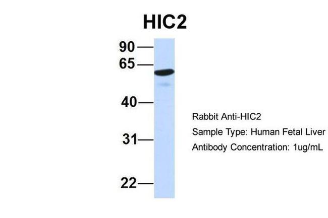 HIC2 Antibody in Western Blot (WB)