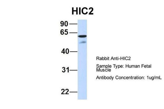 HIC2 Antibody in Western Blot (WB)