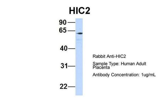 HIC2 Antibody in Western Blot (WB)